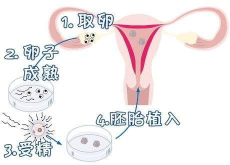 李晴阳院长